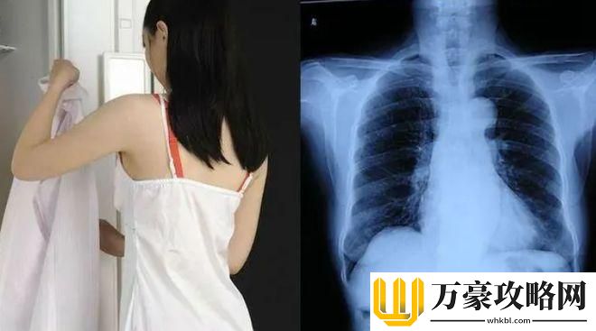 在医学影像中